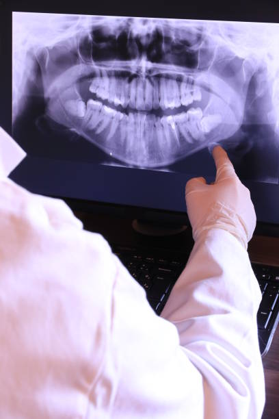 Best Emergency Treatment for Oral Infections in Northlake, SC